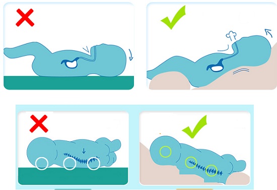goi-chong-trao-nguoc-babieskey-chi-tiet-11